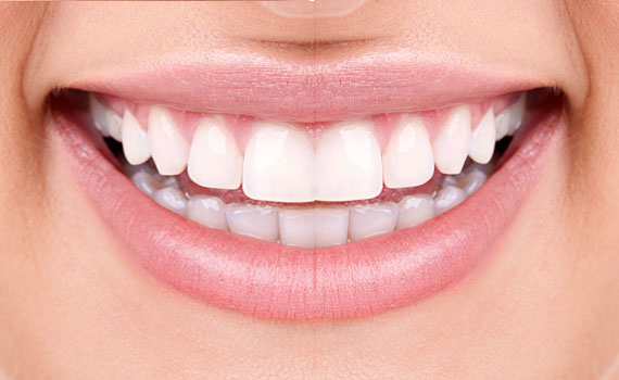 smile-8-2